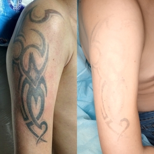 Татуировки, авторские эскизы, удаление тату лазером - Изображение #3, Объявление #1635524